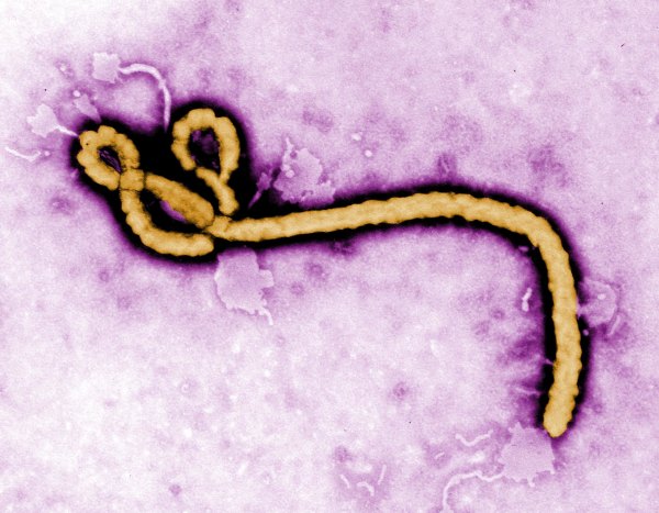 Last December, the FDA approved the release of Ervebo, the first vaccine approved to combat the current Ebola outbreak in the Democratic Republic of Congo. (created by CDC microbiologist  Frederick A. Murphy/flickr)