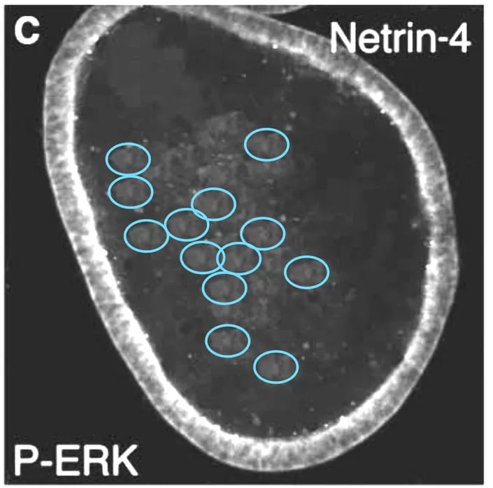 A figure annotated to show several areas with alleged duplication within the image.